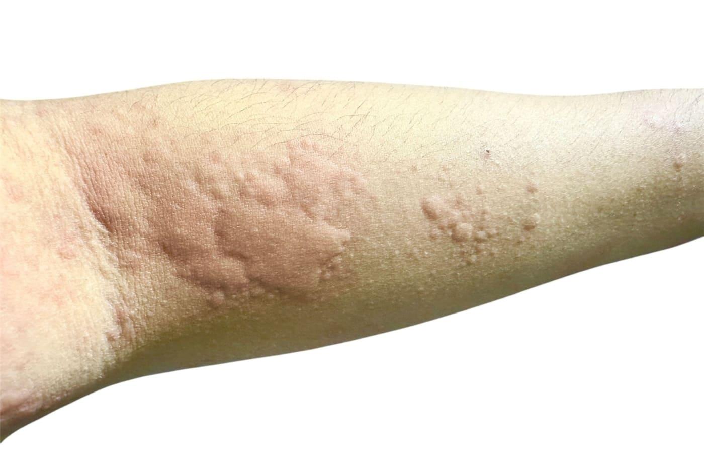 kelopak-garam-cara-hilangkan