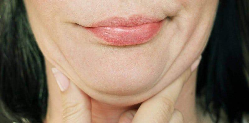 Risau Muka Makin Membulat? Ini 7 Cara Dapatkan Wajah V Shape TANPA Bedah!