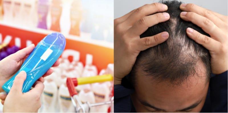Tak Nak Botak Muda? Guna Syampu Untuk Rambut Gugur Yang Ada Bahan Ini!