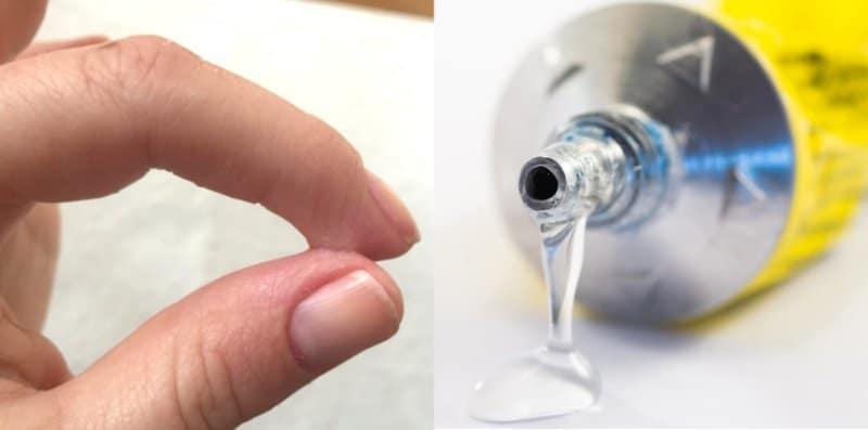 Gam Gajah Terkena Kulit? Cuba 6 Petua Untuk Hilangkannya Tanpa Buat Kulit Mengelupas!