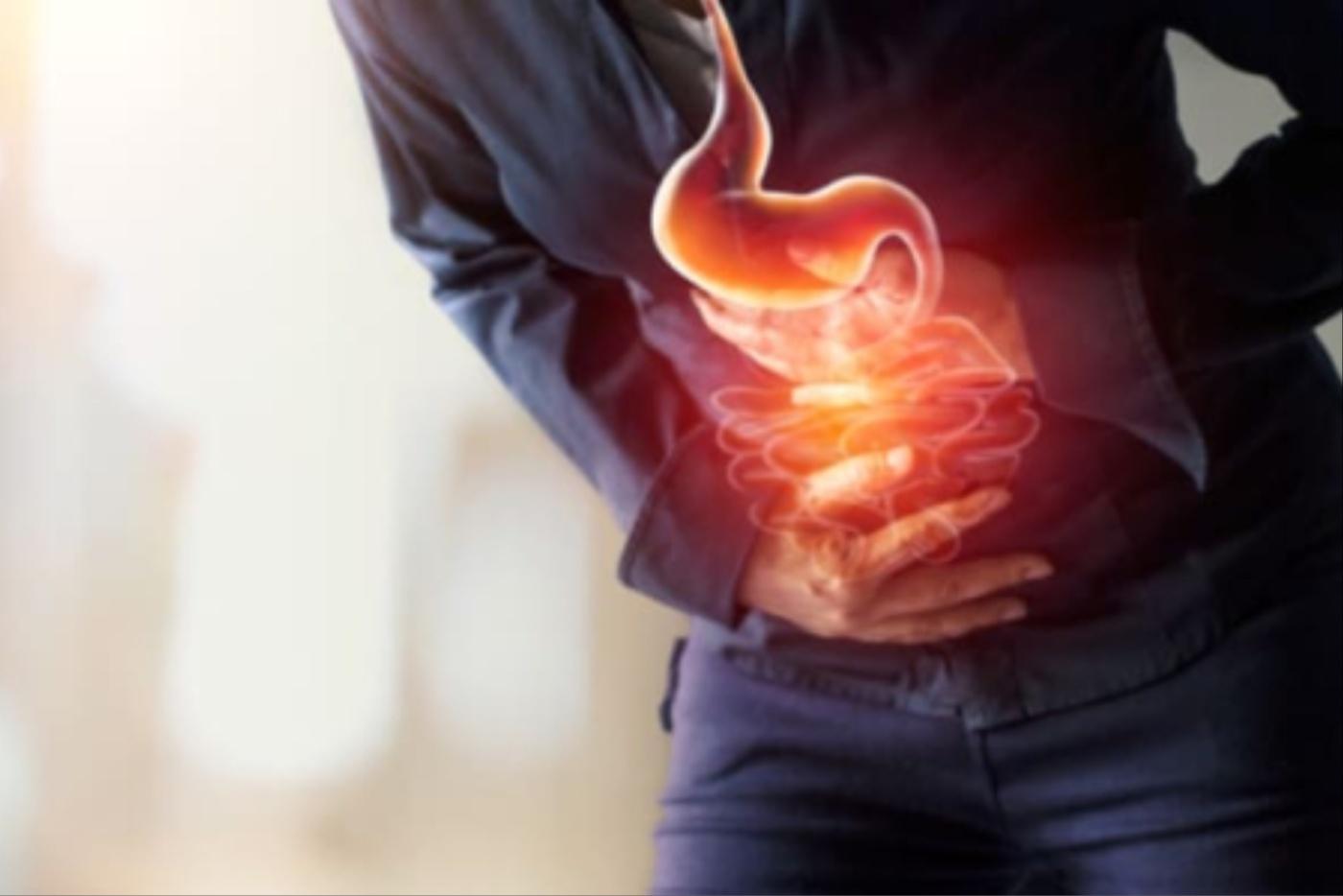 Penyakit Ulser Peptik: Info Lengkap Mengenai Simptom, Punca & Rawatan