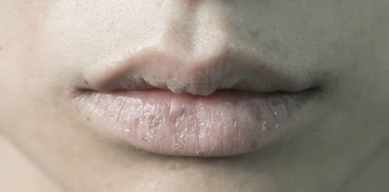 Bahaya Kalau Muka Selalu Pucat! Pasti Puncanya Adalah Salah 1 Daripada 6 Penyakit Ini!