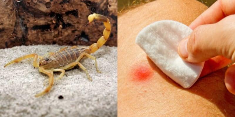 Disengat Kala Jengking Berbisa, Ini Tindakan Yang Sepatutnya Anda Lakukan!