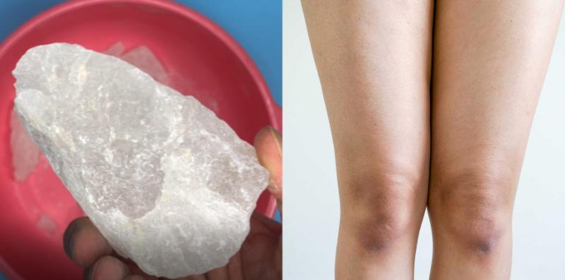 Cari Cara Untuk Putihkan Paha Gelap? Cuba 5 Petua Ini, Mana Tahu Berhasil Untuk Anda!