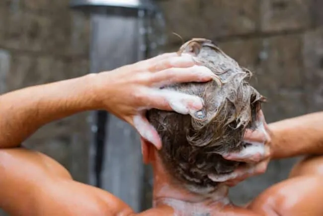 shampoo untuk psoriasis kulit kepala
