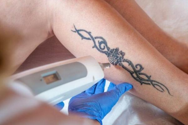 pantang larang penyakit psoriasis
