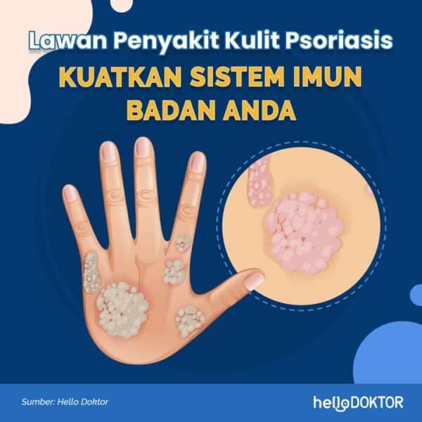 pantang larang penyakit psoriasis