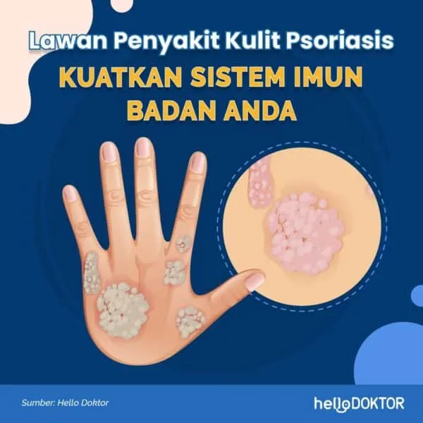 psoriasis kuku