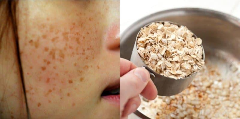 Sapu Oat Sebagai Masker, Ini 5 Petua Hilangkan Jeragat Degil Cara Tradisional!