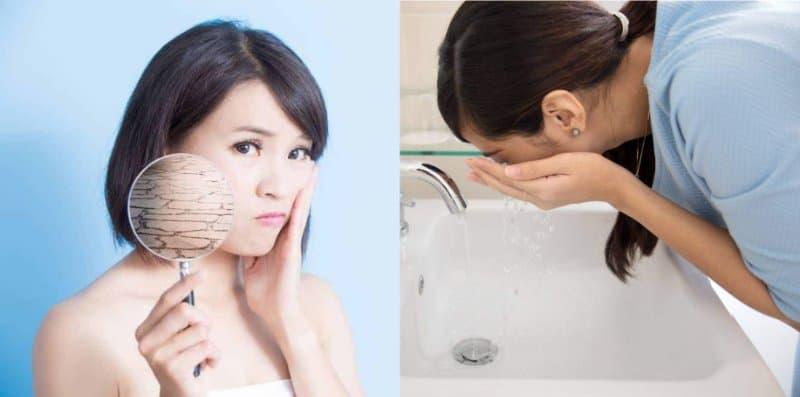 Selalu Sangat Cuci Muka Pun Tak Bagus, Ia Antara 7 Punca Kulit Wajah Kering!