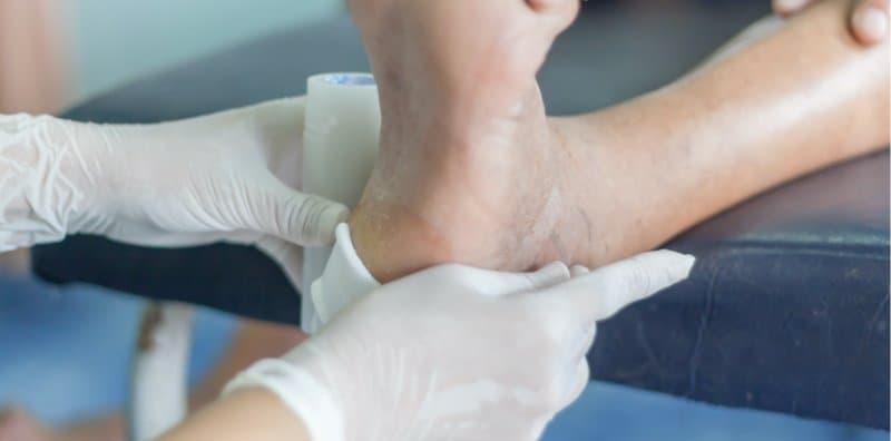 4 Pemeriksaan Kaki Yang Orang Diabetes Wajib Buat Untuk Elak Amputasi!