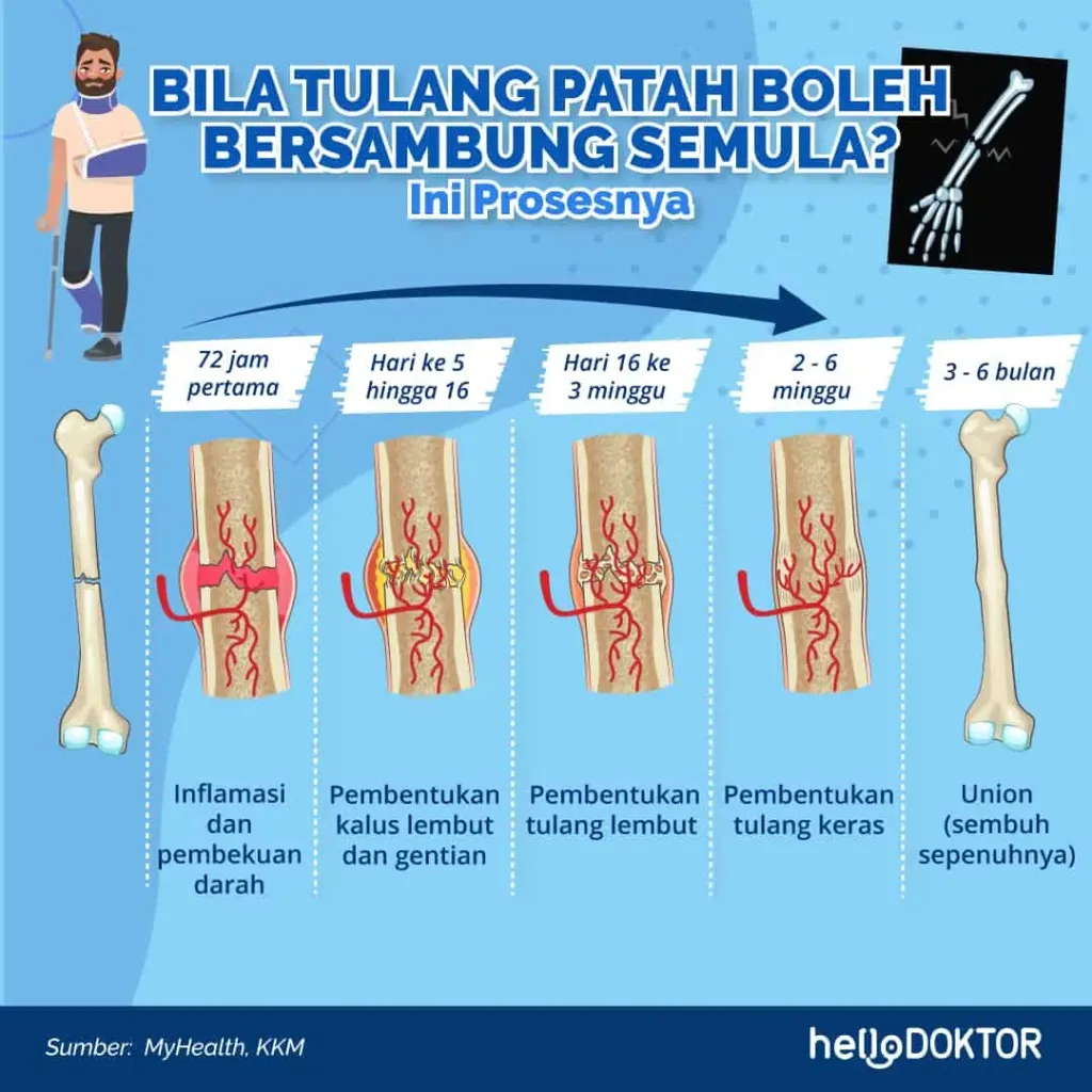 tukang urut patah tulang