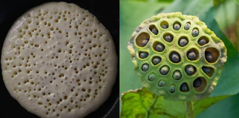 Geli Tengok Gambar Tangan Berlubang, Sampai Menggigil? Anda Mungkin Perlukan Terapi!