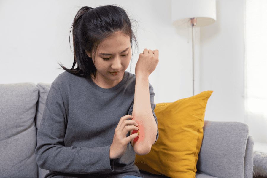 Asyik Tergaru-garu Masa Nak Tidur? Ini 6 Punca Kenapa Badan Gatal-gatal Waktu Malam