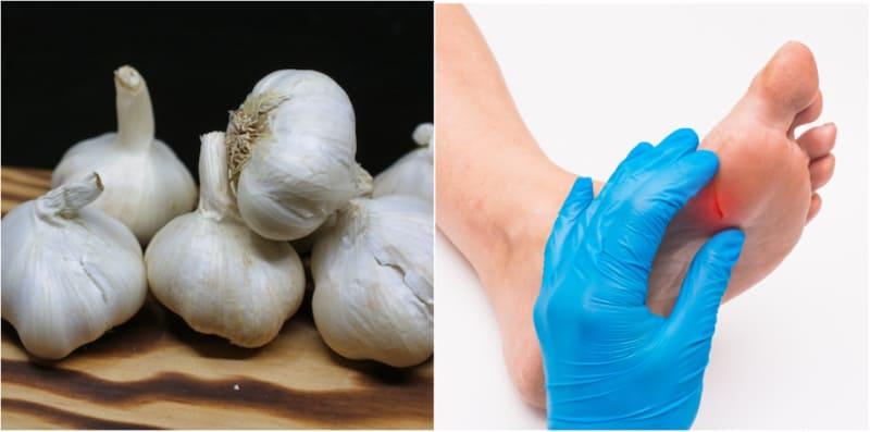 Cari Petua Rawat Luka Kencing Manis? Cuba 5 Bahan Ini, Tapi Cuma Untuk Luka Kecil!