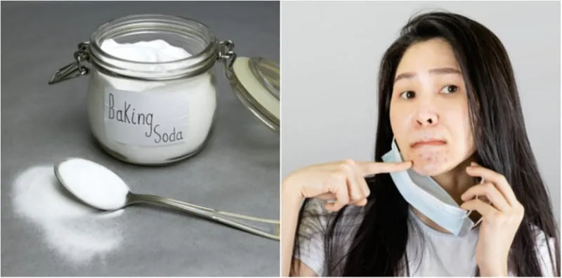 Nak Kulit Lebih Cantik Guna Bahan Dapur? Amalkan Soda Penaik Sahaja, Ada 8 Manfaat!