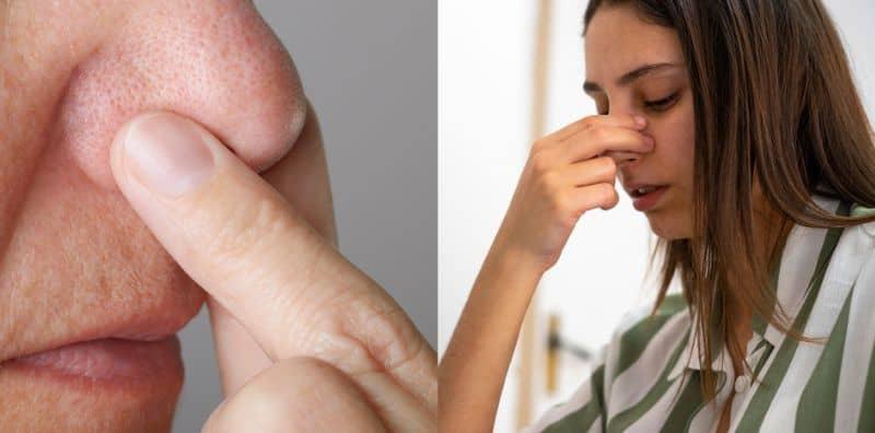 Rimasnya, Hidung Tersumbat Tapi Tidak Selesema? 6 Faktor Ini Mungkin Puncanya!