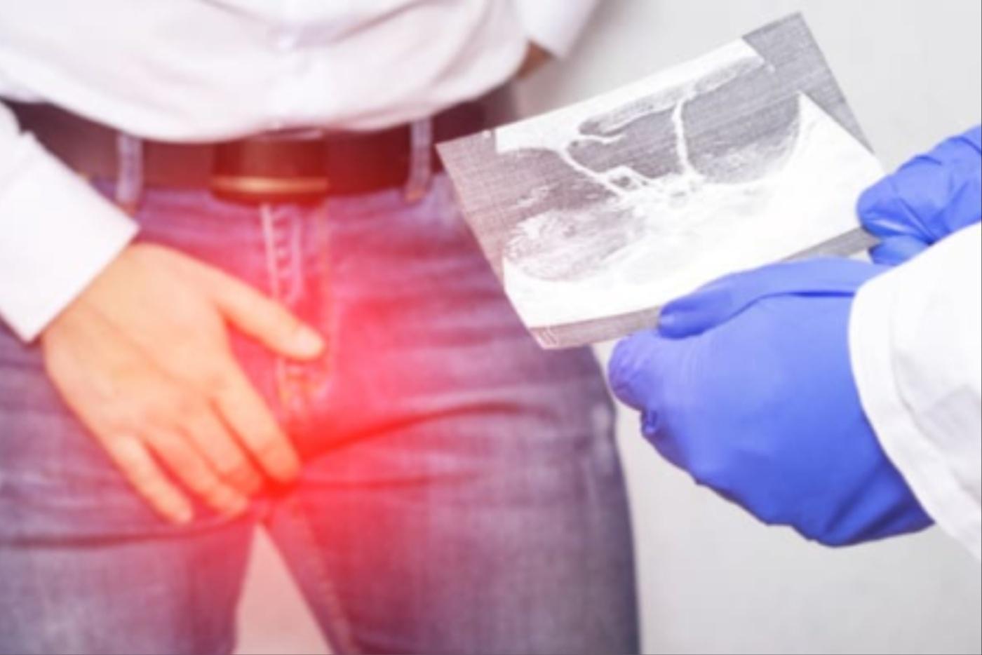 Lelaki Ada Masalah Angin Pasang? Elakkan 5 Perkara Ini Kalau Nak Cepat Sembuh!