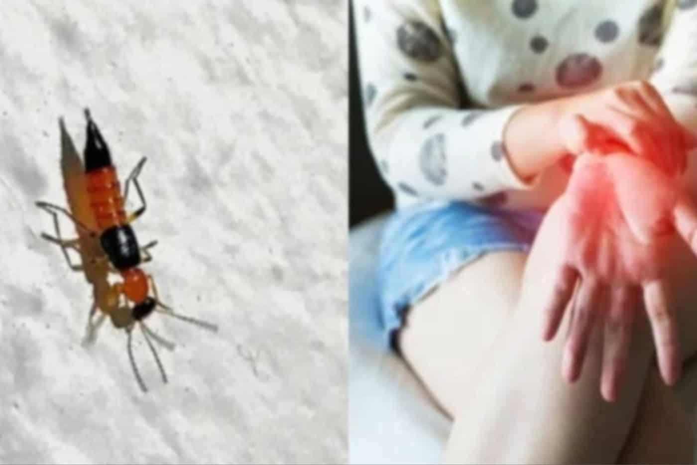 Kena Gigit Semut Charlie? JANGAN Sentuh! Bisanya Boleh Buat Anda Jadi Buta!