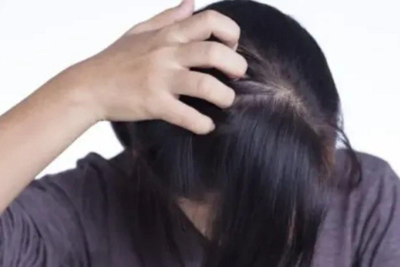 Kulit Kepala Gatal & Kering? Ini 12 Bahan Penting Dalam Syampu Yang Boleh Bantu Legakan!