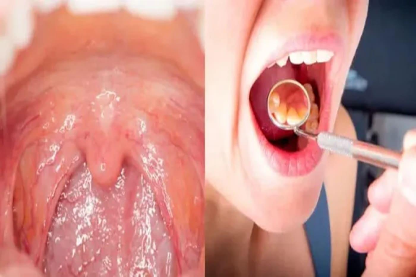 Lelangit Bengkak & Merah? Awas, 5 Punca Ini Paling Kerap Berlaku!