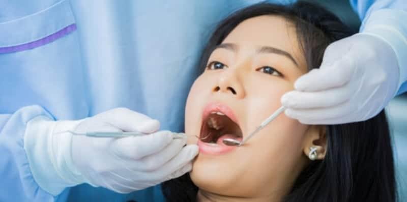 Bahaya Cabut Gigi Geraham Lebih Satu Batang Sehari? Sebelum Cabut, Ambil Tahu Dulu!