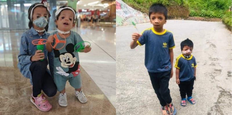 Miliki Anak Dengan Penyakit Jarang Jumpa, Pembakar Semangat Buat Ibu Ayah Ini!