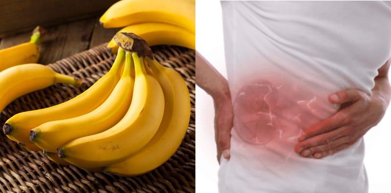 Pisang TAK Elok Untuk Buah Pinggang? Ini 6 Jenis Makanan Anda Kena Elak!