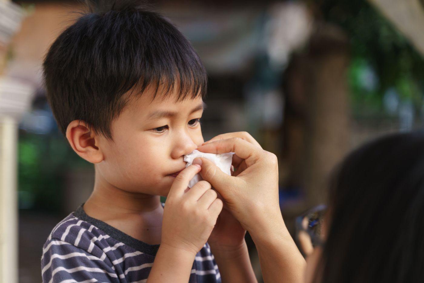 Hidung Anak Berdarah Sebab Cuaca Panas? Ini Cara TERPANTAS Untuk Hentikannya!