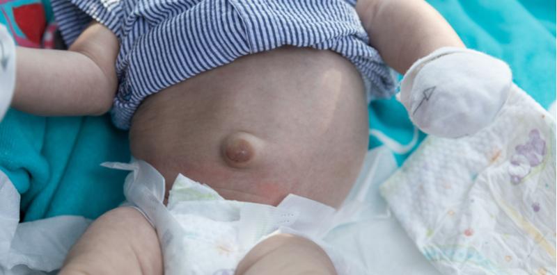 Ibu, Kenal Pasti Tanda Angin Pasang Pada Si Manja, Bahaya Jika Dibiarkan!