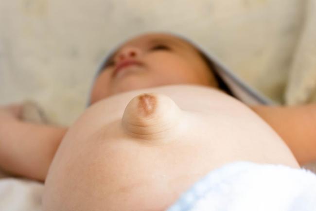 Pusat Bayi Timbul? Jangan Panik, Ini Cara Rawat & Elak Jadi Serius!