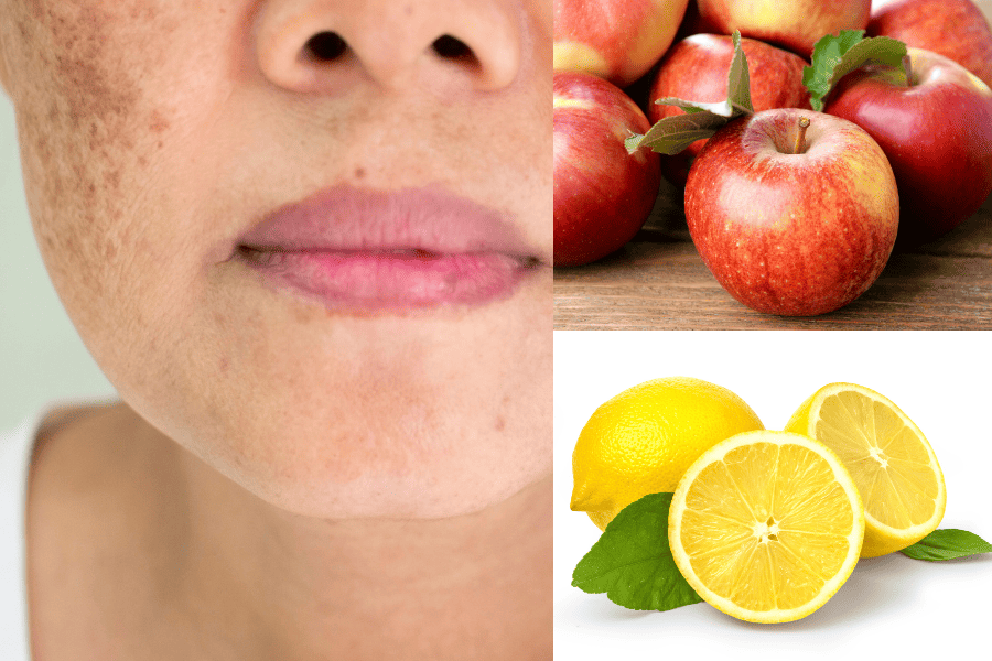 Hilangkan Jeragat Degil Dengan 7 Bahan Dapur Ini, 2 Buah Ini Katanya Berkesan!