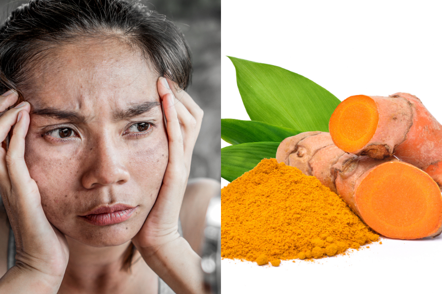 Guna Masker Kunyit Untuk Rawat Jeragat, Berkesan Ke Cara Tradisional Ini?