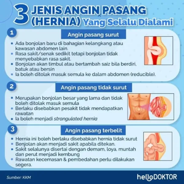 pusat bayi timbul