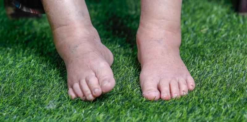 6 Tanda Awal Anda Mungkin Alami Sakit Buah Pinggang Tahap 1, Jaga-Jaga!