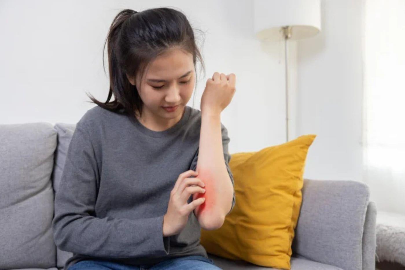 Jangan Abaikan Gatal-Gatal Badan – 7 Punca Ini Boleh Datang Dari Bakteria!