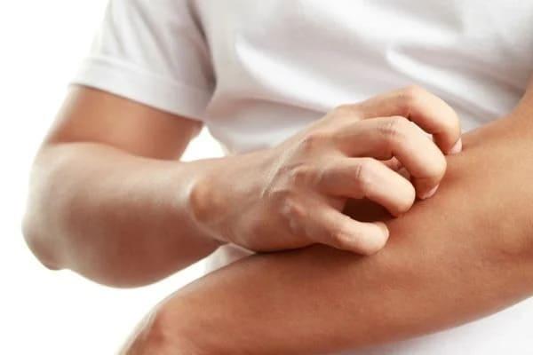 kenapa badan gatal gatal