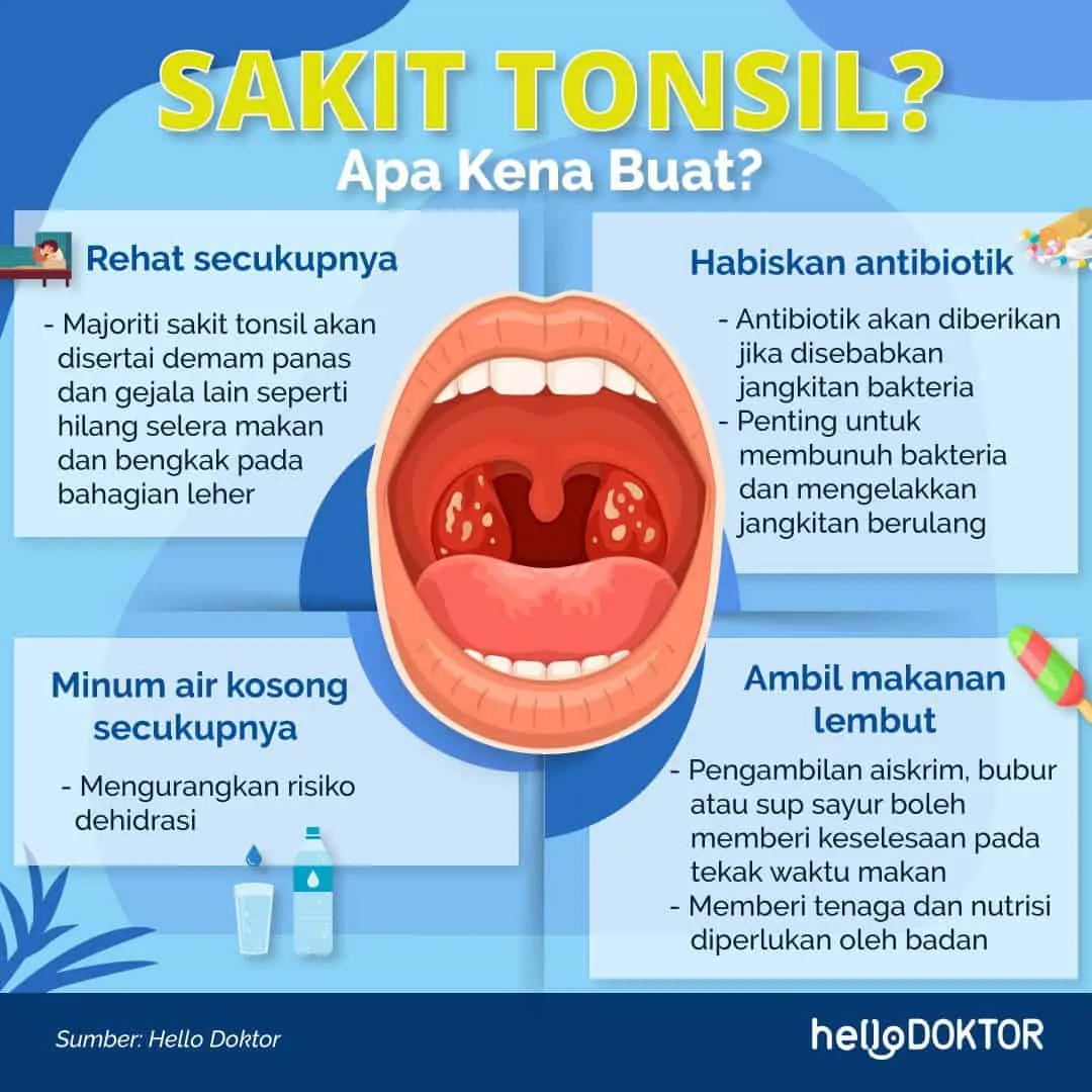 ubat tonsil bengkak