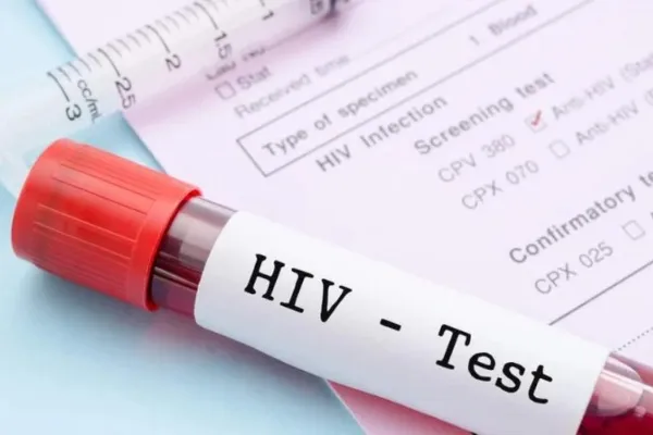 tanda-tanda hiv pada wanita