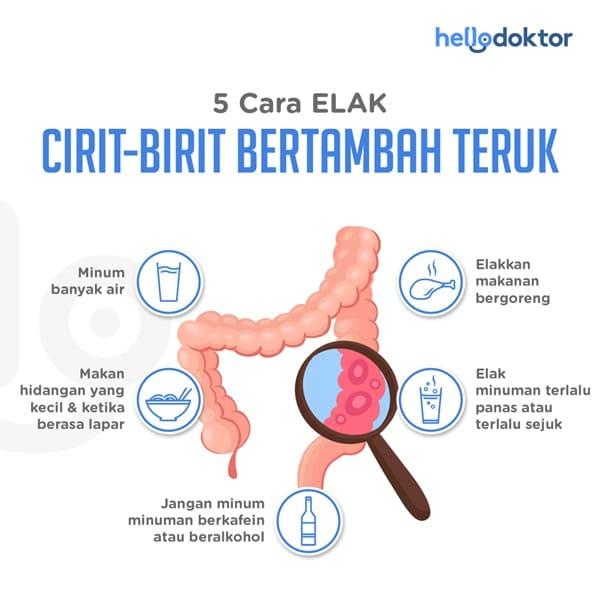 cirit birit budak