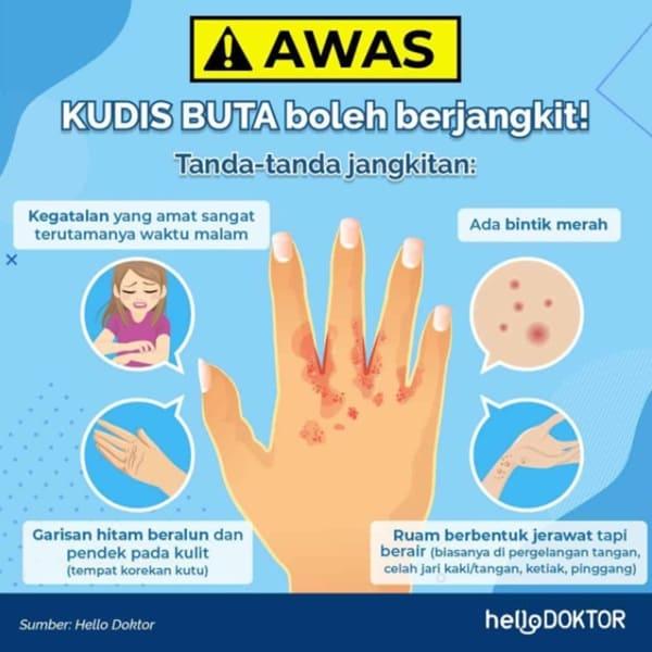kudis api