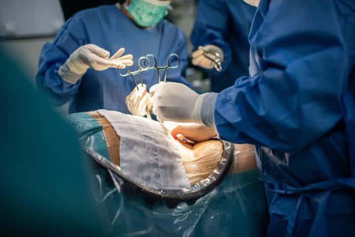 cesarean section