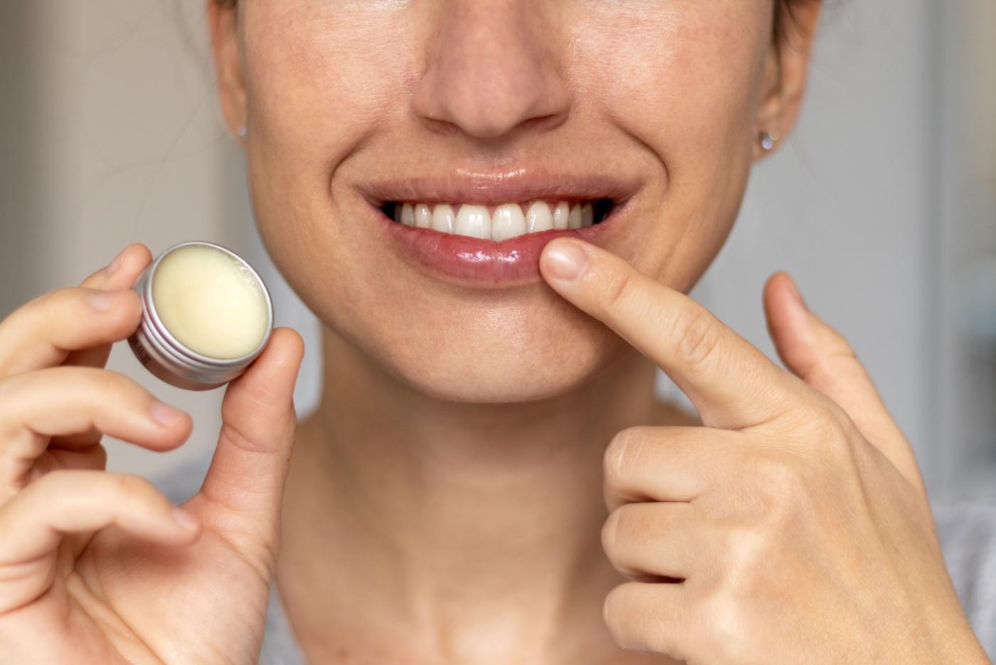 Bibir Merekah? Ini Cara Terbaik Pilih Lipbalm Untuk Bibir Kering!