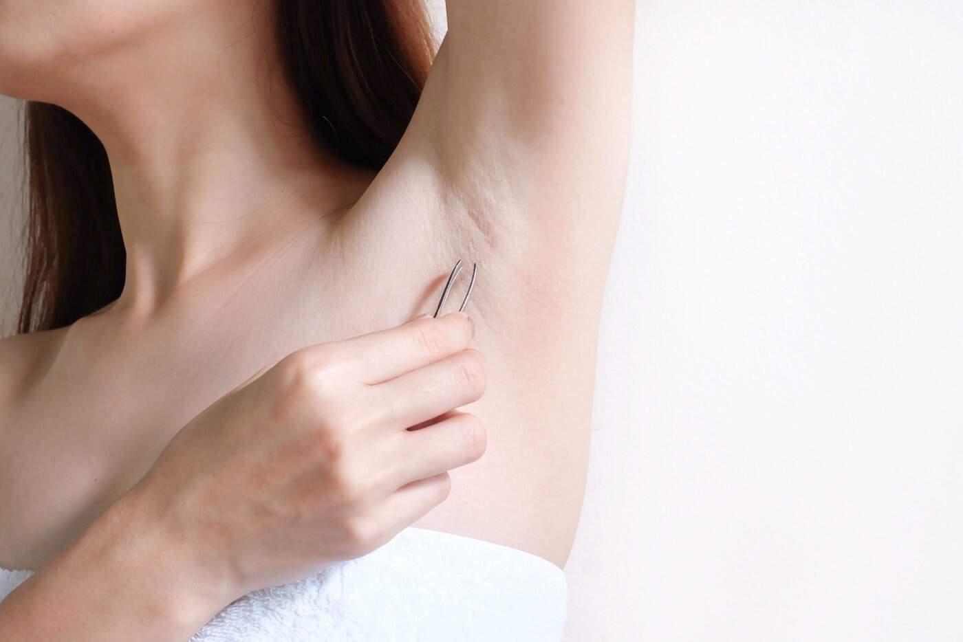 Suka Cabut Bulu Ketiak? Ini Cara Paling Selamat Untuk Lakukannya