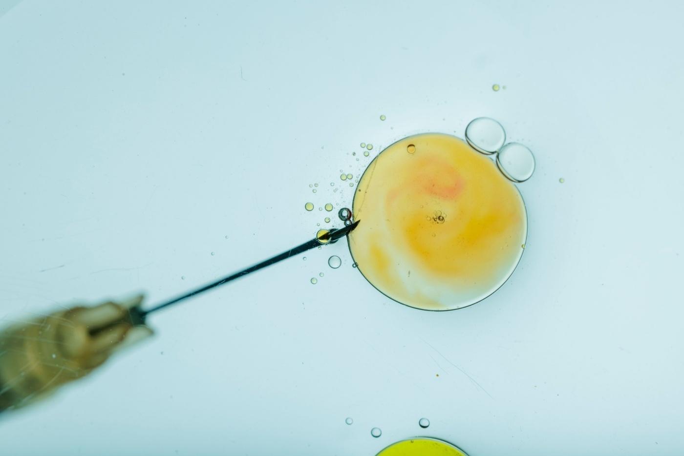 Ingin Lakukan IVF? Ketahui Kos Serta Risikonya Terlebih Dahulu!