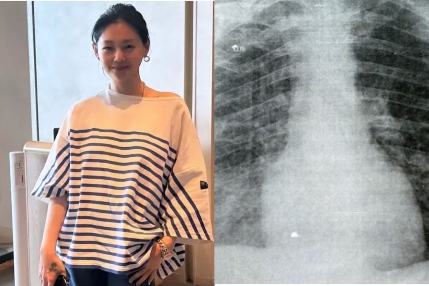 Bintang Drama Popular 'Meteor Garden', Barbie Hsu Meninggal Dunia Akibat Influenza