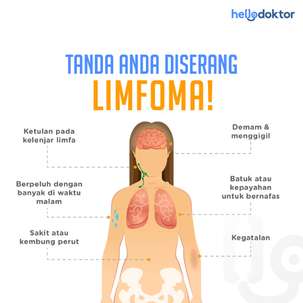 simptom kanser limfoma