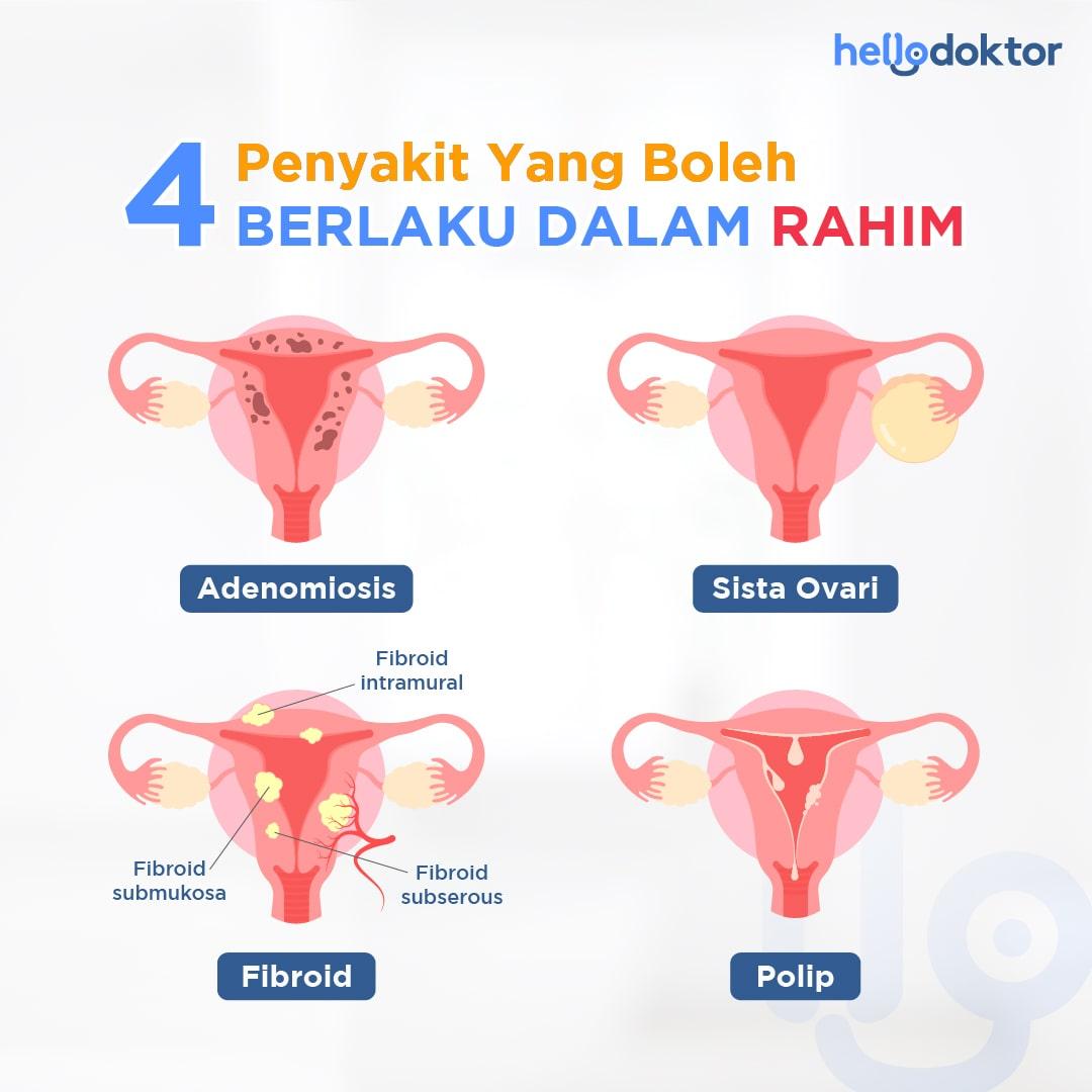 rahim perempuan