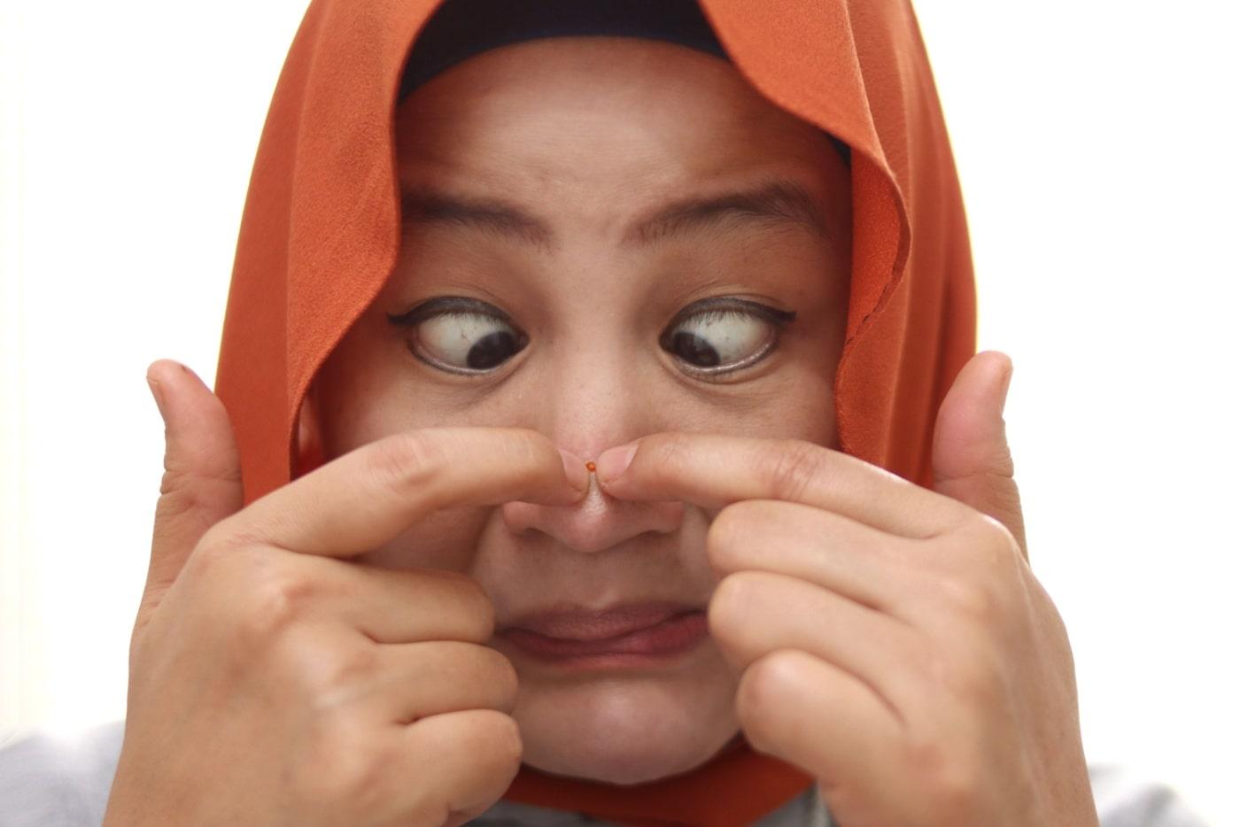 Jangan Main Picit Kat Hidung! Jerawat Kat Kawasan Ni Boleh Bawa Maut Kalau Nasib Tak Baik