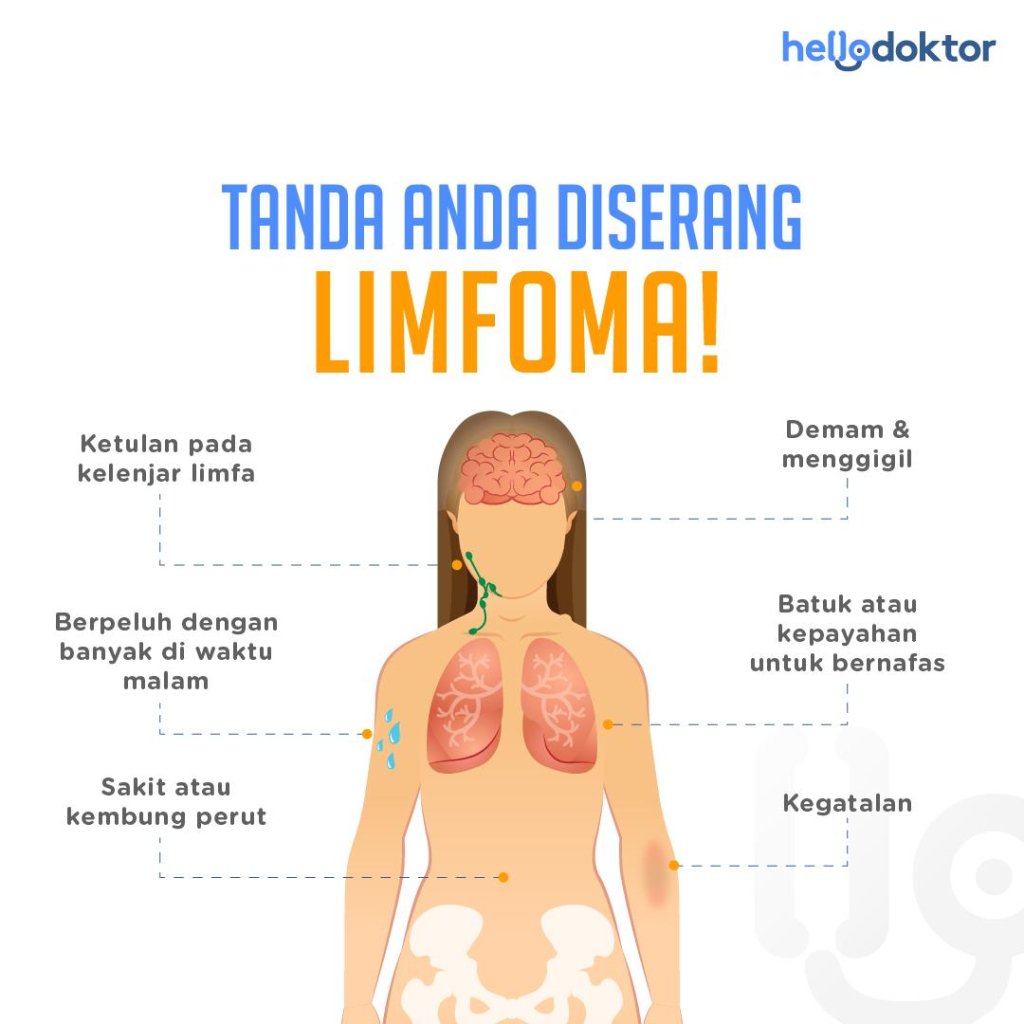 punca kanser limfoma